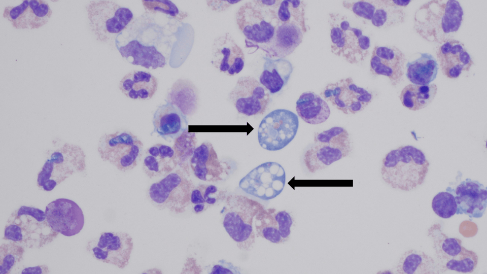Missouri Resident Dies After Contracting Rare Brain-Eating Amoeba at Lake of the Ozarks