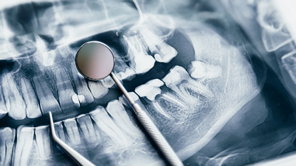 Rural Parish Dental Clinic Now in Jefferson County